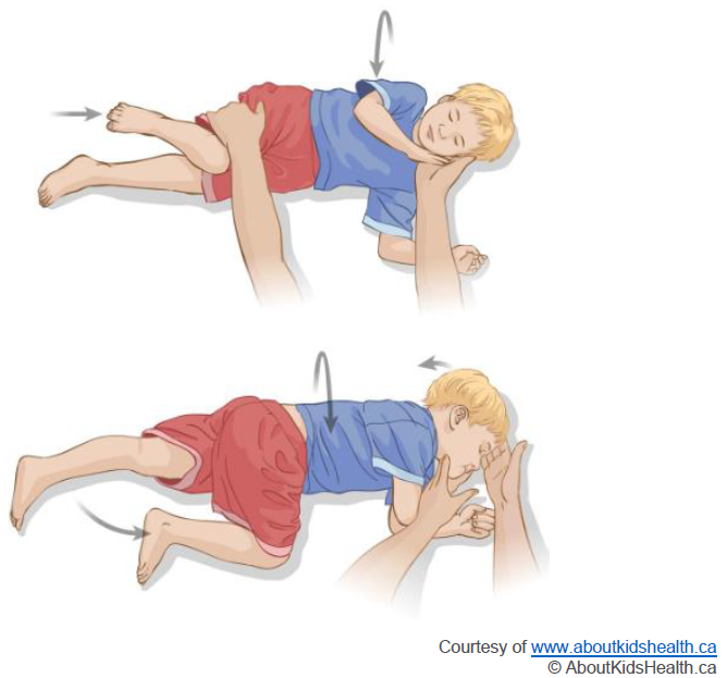 seizure recovery position.png